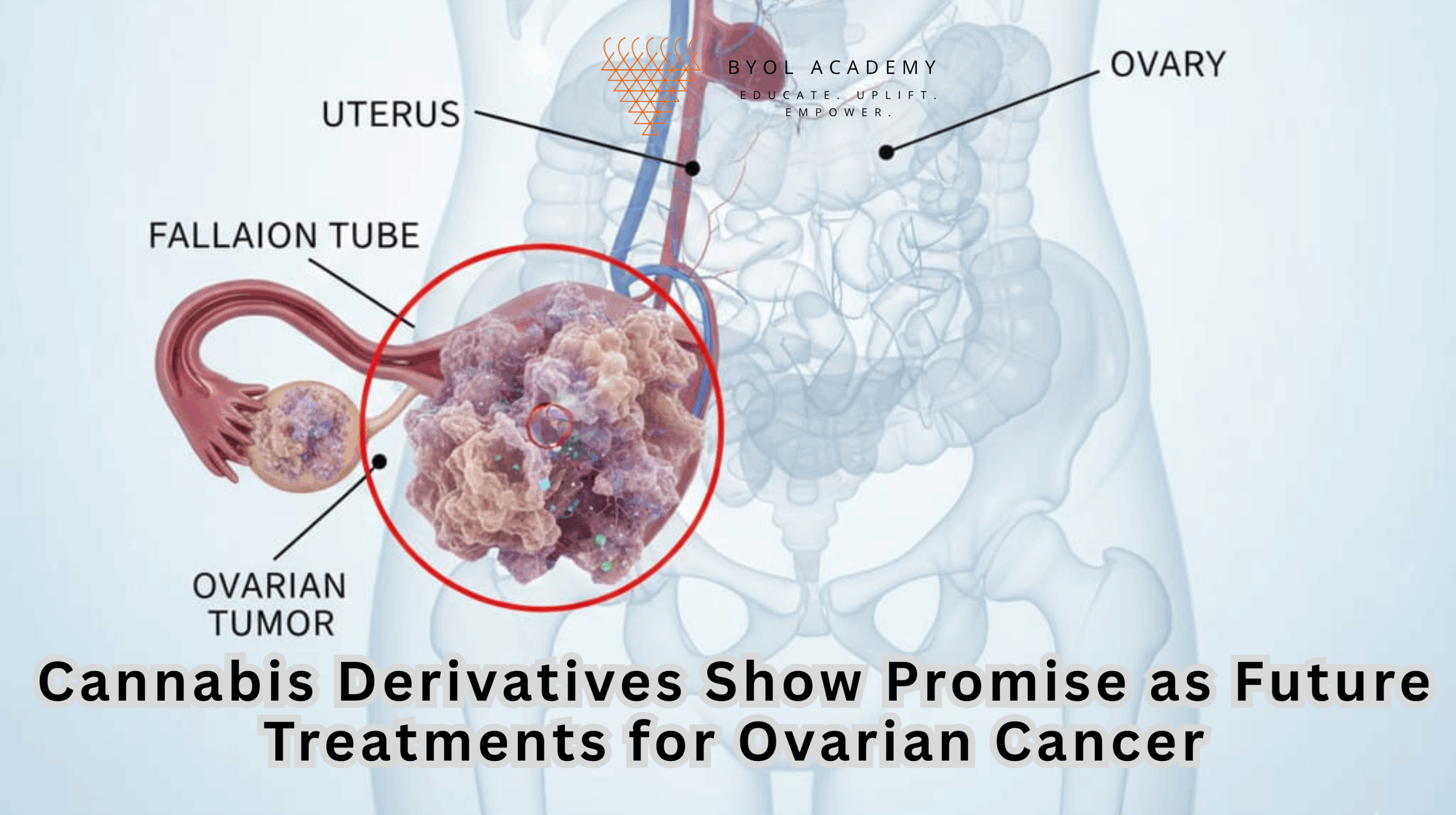 Cannabis Derivatives Show Promise as Future Treatments for Ovarian Cancer